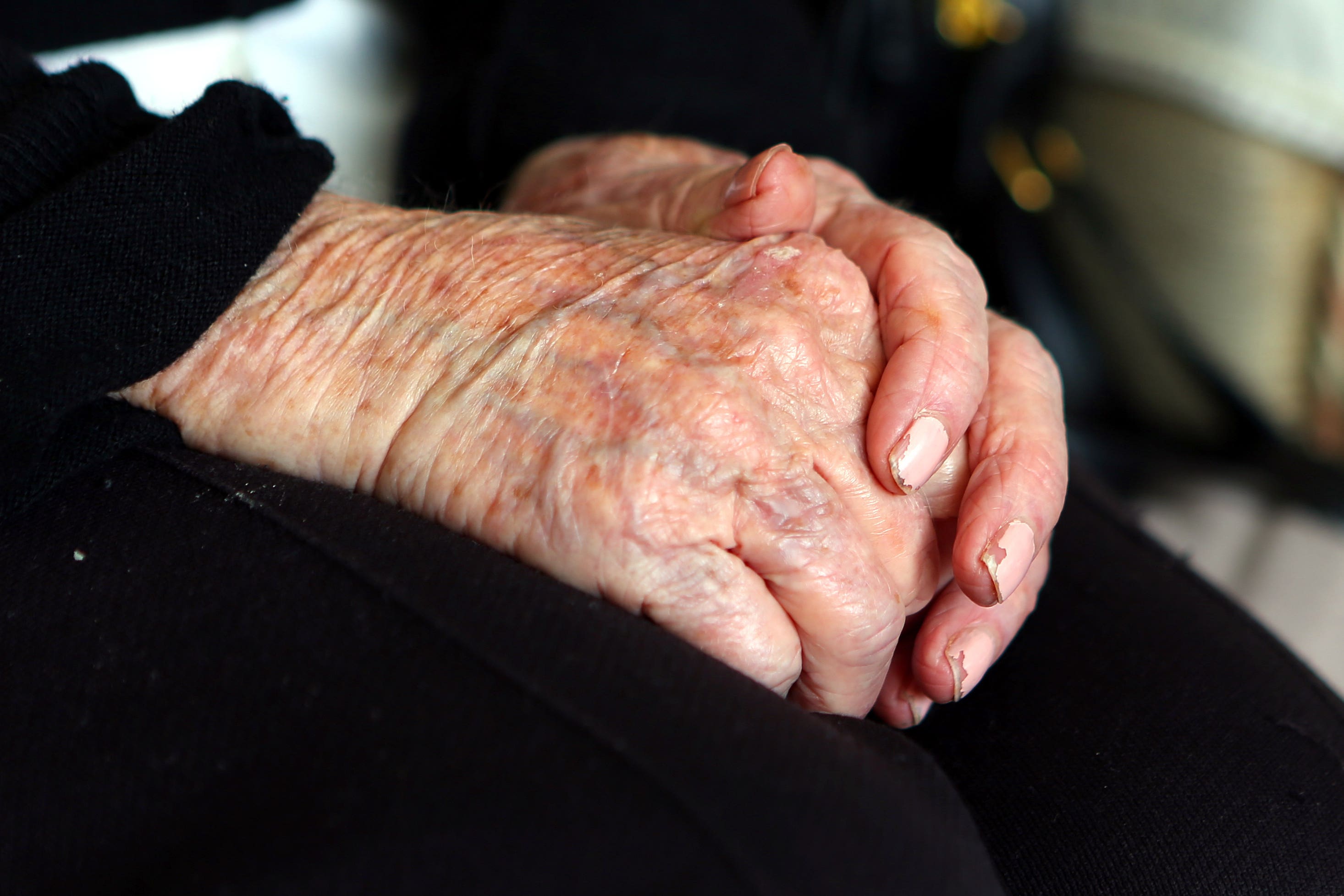 The findings challenge a cornerstone of Alzheimer’s research